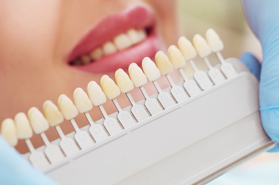 вред и польза отбеливание зубов